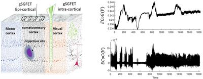 Impact of DC-Coupled Electrophysiological Recordings for Translational Neuroscience: Case Study of Tracking Neural Dynamics in Rodent Models of Seizures